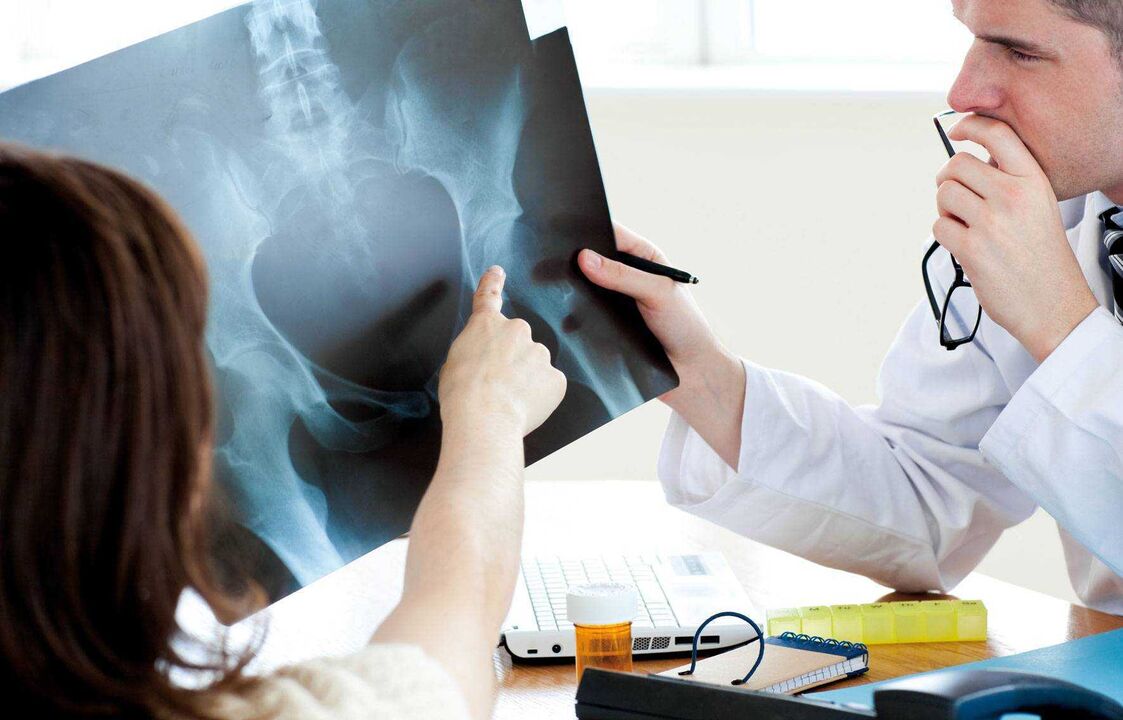 doctors who perform x-rays for hip osteoarthritis