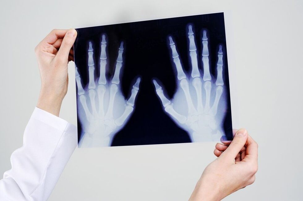 hand joint diagnostics
