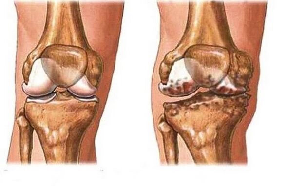 Healthy and pain