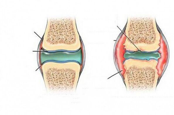 The deformation process of the combination
